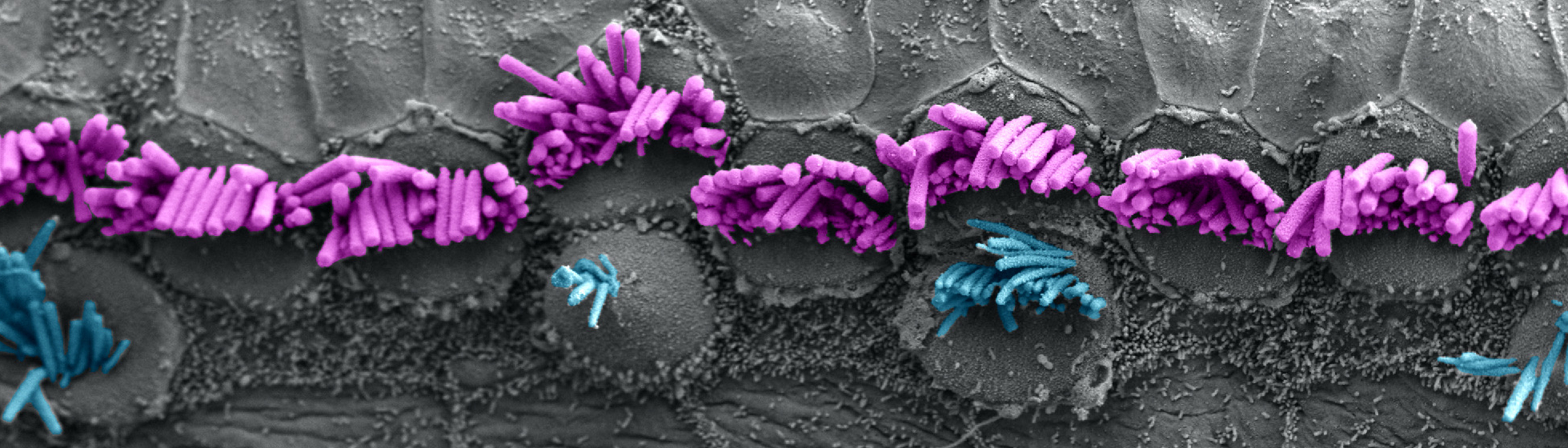 腦智卓越中心發(fā)現(xiàn)耳蝸內(nèi)毛細胞發(fā)育和轉(zhuǎn)分化依賴Tbx2